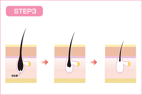 脱毛サイクル_step3